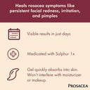 prosacea---medicated-rosacea-treatment-f-3.jpg
