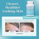clear-skin-vitamins-for-women-men---supp-2.jpg