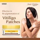 anti-vitiligo-cream-super-effective-on-v-2.jpg