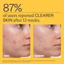 nutrafol-clear-skin-acne-supplement-for--4.jpg