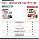 medical-grade-silicone-scar-tape-advance-2.jpg