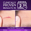 cicatricure-advanced-scar-gel-proven-res-71ZmMBgVOtL.jpg