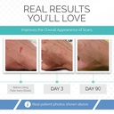clinically-proven-silicone-scar-sheets-m-71ekBHO+NWL.jpg