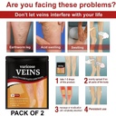 varicose-vein-relief-patch-cooling-leg-c-71Kn2Pw6QXL.jpg