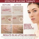 physician-formulated-silicone-scar-gel-s-3.jpg