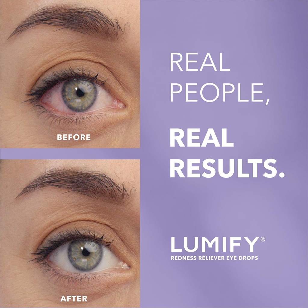 lumify-redness-reliever-eye-drops-for-wh-2.jpg