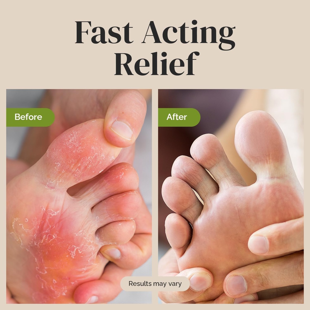 puriya-clinically-proven-antifungal-crea-3.jpg