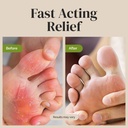 puriya-clinically-proven-antifungal-crea-3.jpg