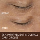freemood-eye-cream-for-dark-circlesanti--5.jpg