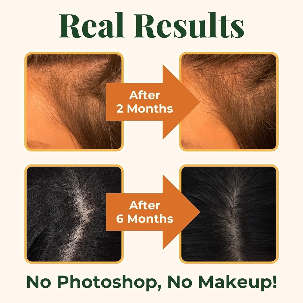 heebins-hair-growth-supplements-with-bio-3.jpg