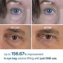 drmelaxin-eyephalt-eyebag-cream-10ml-3.jpg