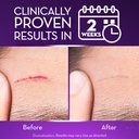 cicatricure-advanced-scar-gel-for-face-b-3.jpg