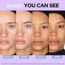 zitsticka-vitamin-acne-supplement-for-cy-4.jpg