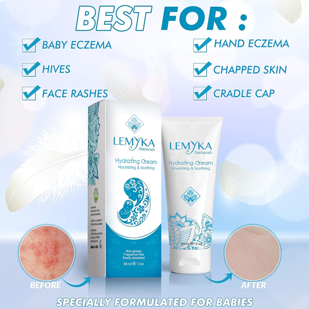 baby-cream-for-eczema-psoriasis-prone-it-2.jpg
