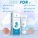 baby-cream-for-eczema-psoriasis-prone-it-2.jpg