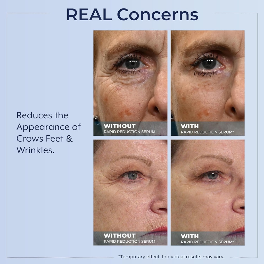 plexaderm-rapid-reduction-eye-serum---vi-5.jpg