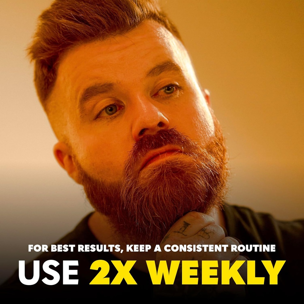 beard-club-premium-derma-roller-beard-gr-5.jpg