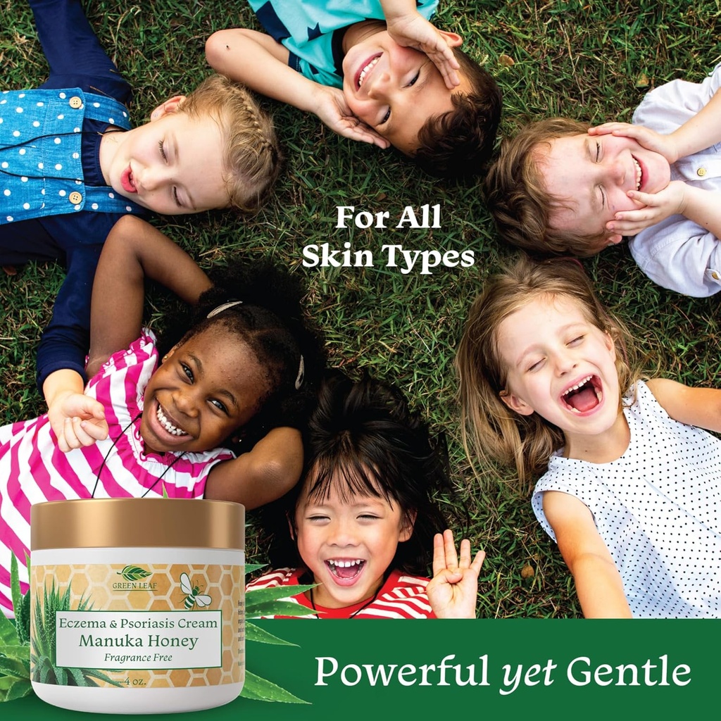 manuka-honey-eczema-cream-moisturizing-l-5.jpg