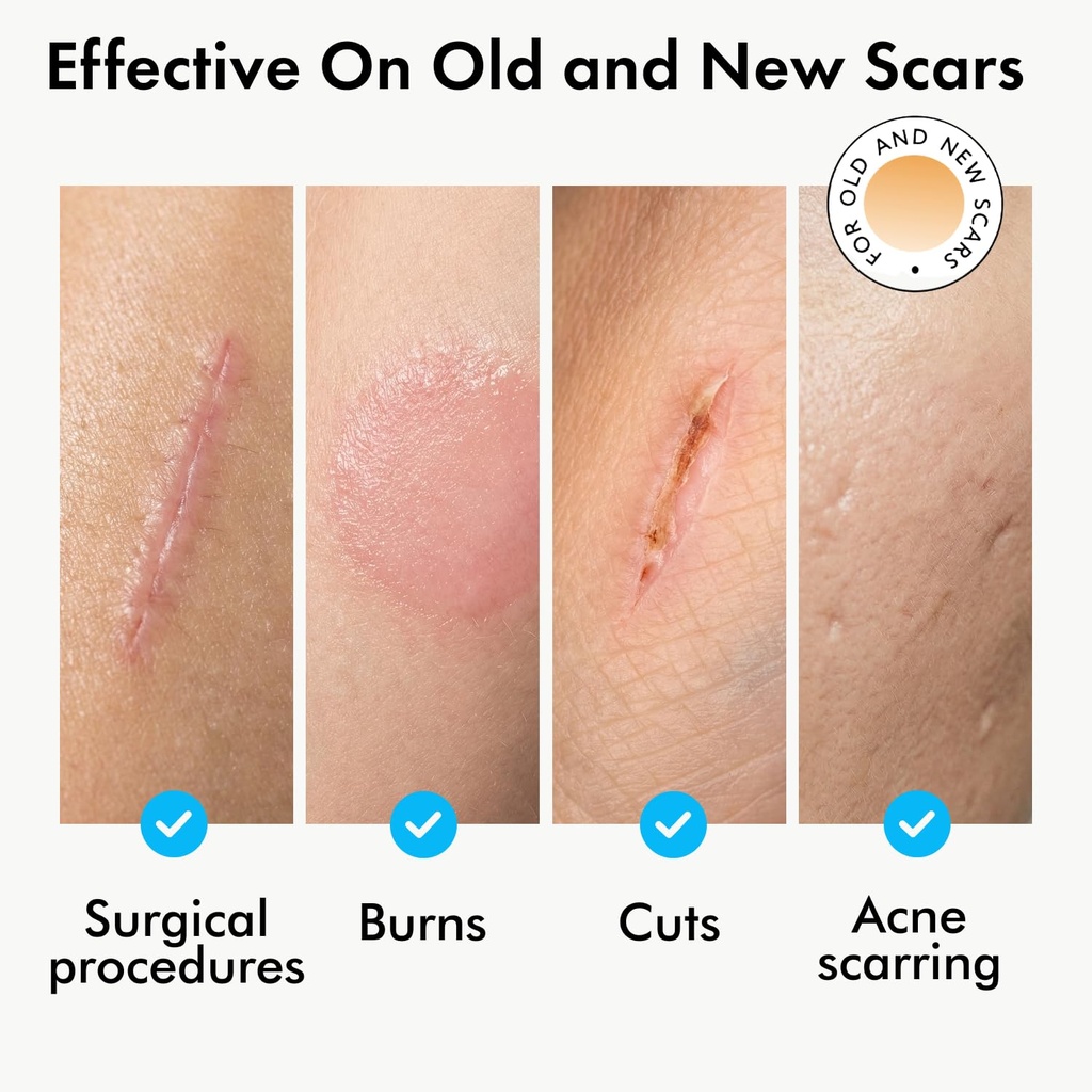 serica-scar-gel-1oz-advanced-silicone-fo-3.jpg