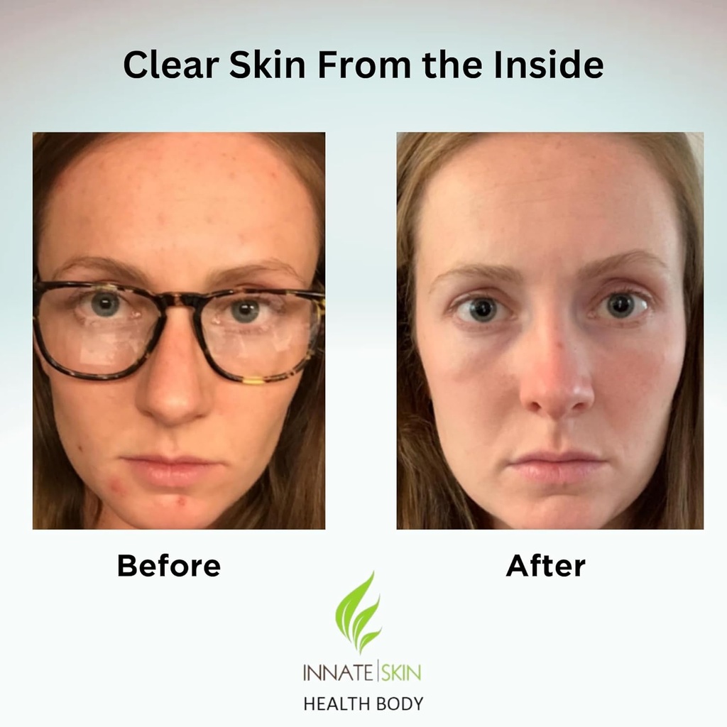 clear-skin-acne-vitamin-system-20-antiox-2.jpg