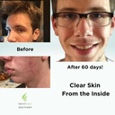 clear-skin-acne-vitamin-system-20-antiox-3.jpg