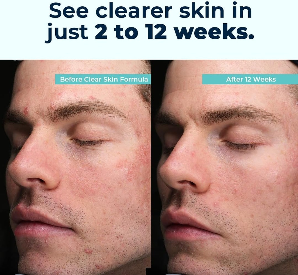 vitamedica-clear-skin-vitamin-formula-no-3.jpg
