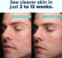 vitamedica-clear-skin-vitamin-formula-no-3.jpg