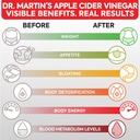 pure-1950mg-apple-cider-vinegar-suppleme-6.jpg