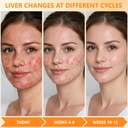 liver-cleanse-detox-for-women-milk-thist-6.jpg