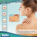 professional-silicone-scar-sheets-16-x-1-4.jpg