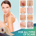 professional-silicone-scar-sheets-16-x-1-6.jpg