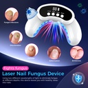 nail-fungus-laser-treatment-led-light-de-2.jpg