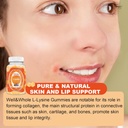 l-lysine-gummies-1000mg---l-lysine-suppl-5.jpg