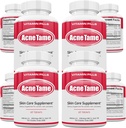 Píldoras de acné Suplemento- Vitaminas de piel clara Píldora para el tratamiento de la piel oleaginosa, Blemishes hormonales, Anti Spots & Cystic Acnes Suplementos para Mujeres, Hombres, Adolescentes & Adultos- 240 Tabletas orales