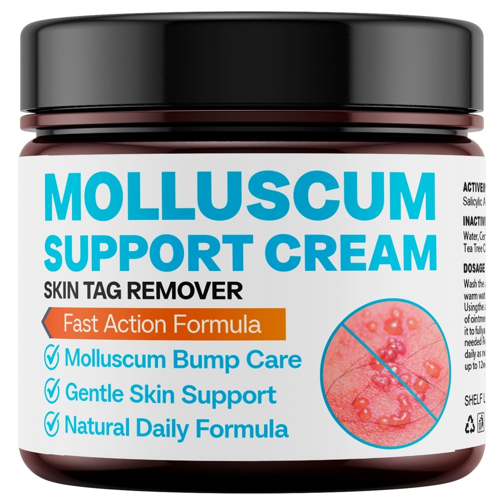 Molluscum Support Treatment, Molluscum Support Cream All Natural Support Cream for Molluscum Rash, SALICYLIC Acid 10%