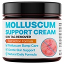 Molluscum Support Treatment, Molluscum Support Cream All Natural Support Cream for Molluscum Rash, SALICYLIC Acid 10%